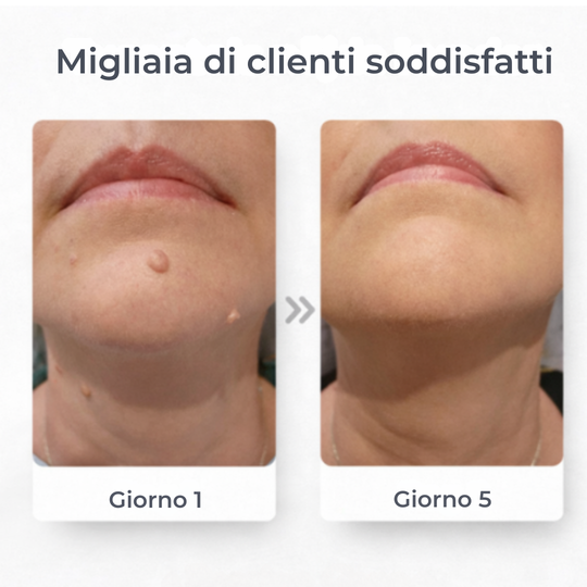 Lovera Care – Cerotti per la pelle