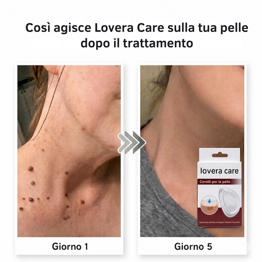 Lovera Care – Cerotti per la pelle