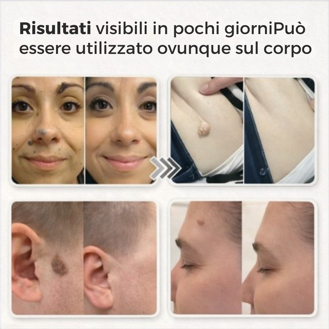 Lovera Care – Cerotti per la pelle
