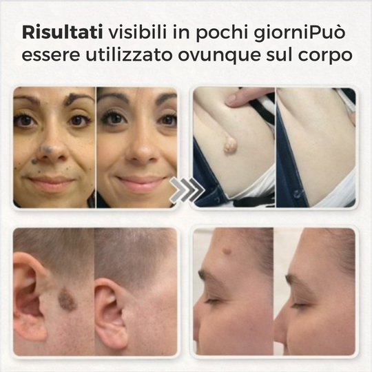 Lovera Care – Cerotti per la pelle
